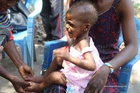 Maniema : Le PADRIR renforce les capacités des nutritionnistes pour lutter contre la malnutrition chronique
